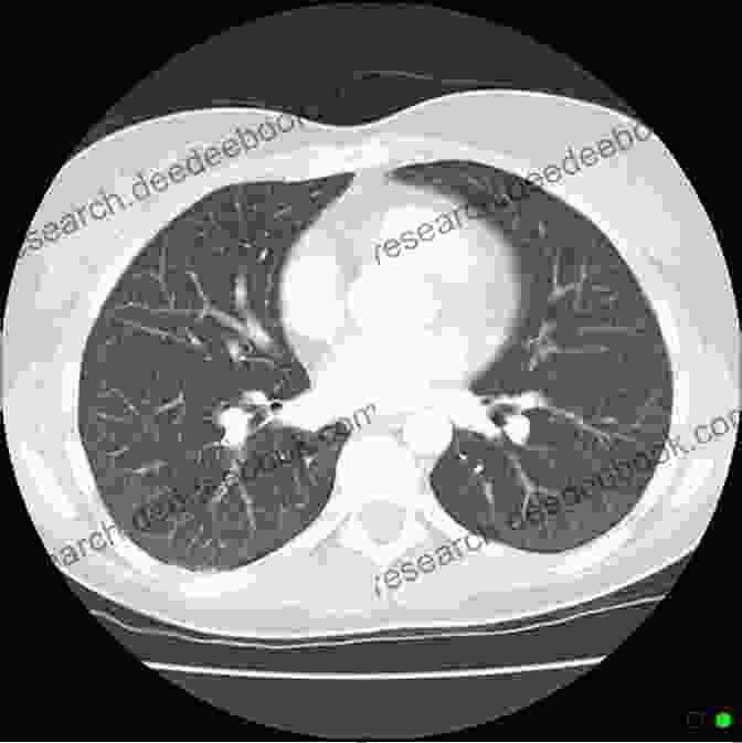 Thoracic Imaging CT Scan Of The Lungs Thoracic Imaging The Requisites (Requisites In Radiology)