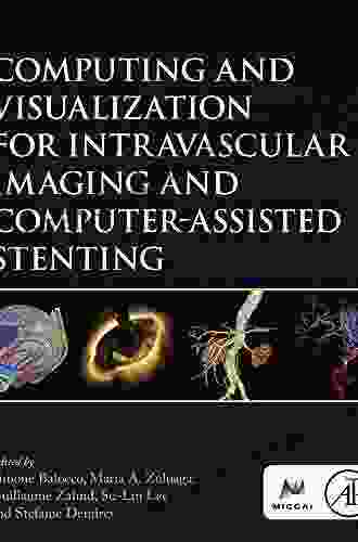 Computing And Visualization For Intravascular Imaging And Computer Assisted Stenting (The MICCAI Society Series)