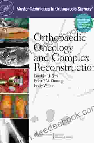 Master Techniques In Orthopaedic Surgery: Orthopaedic Oncology And Complex Reconstruction
