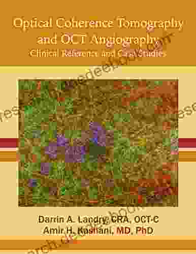 Optical Coherence Tomography And OCT Angiography